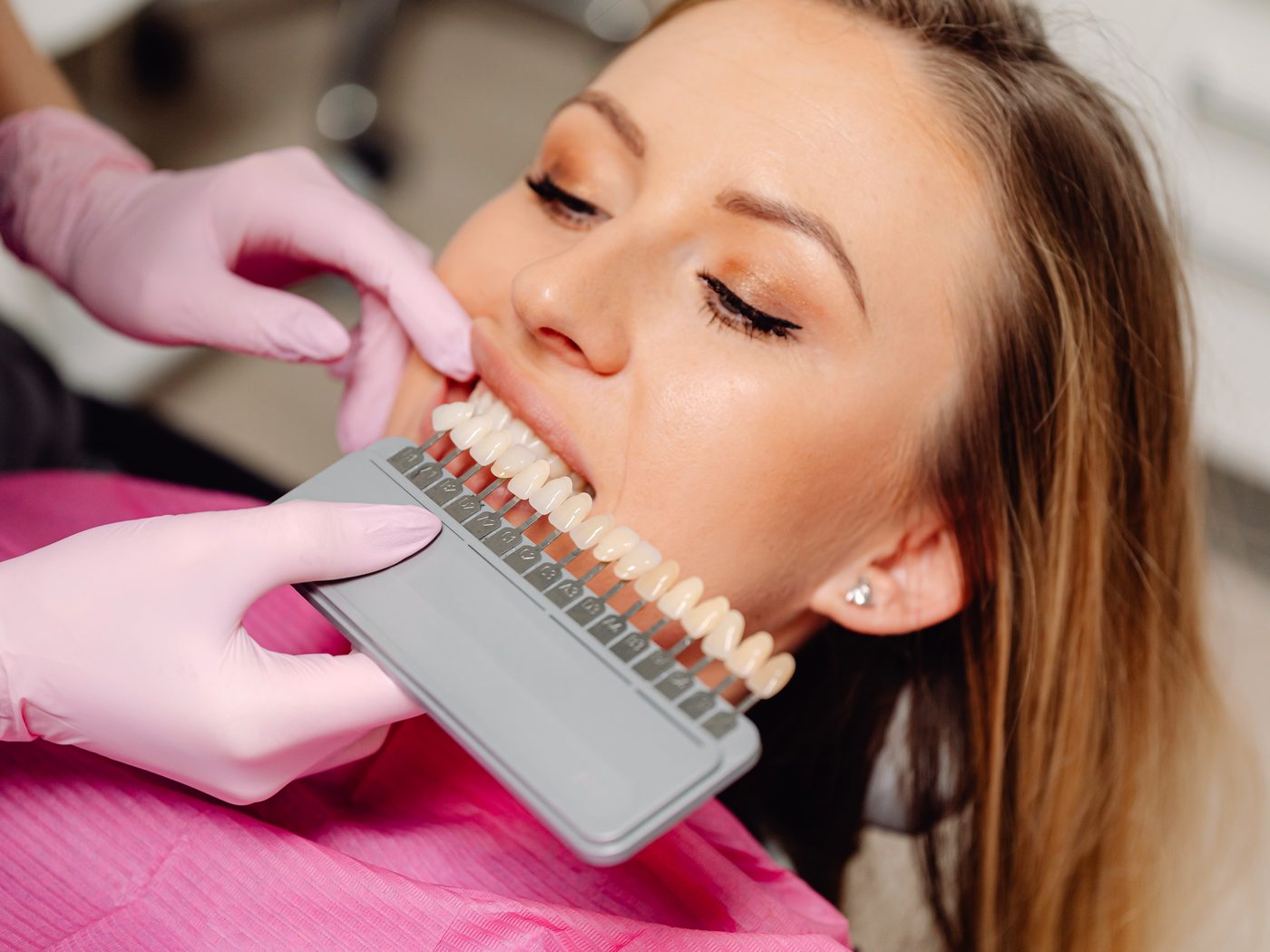 Teeth Whitening at Kamalaa Dental Clinic