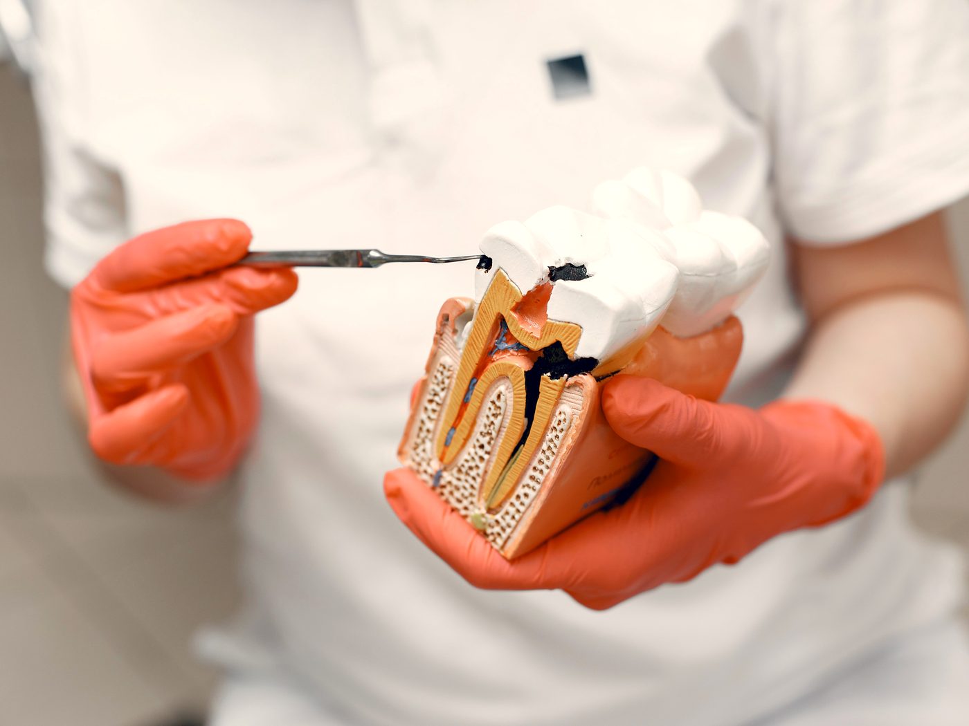 Root Canal Treatment at Kamalaa Dental Clinic